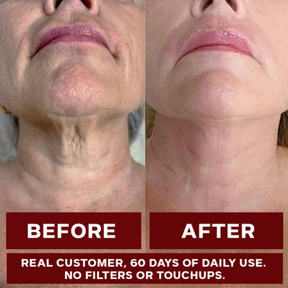 VapoShine Zooone™ NAD+ Berry Flavor Drink Mix